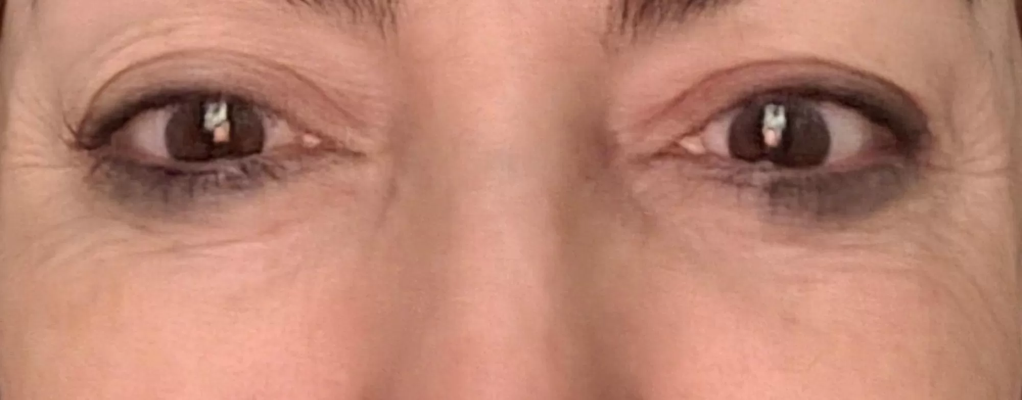  Bağcılar Kolajen İp 