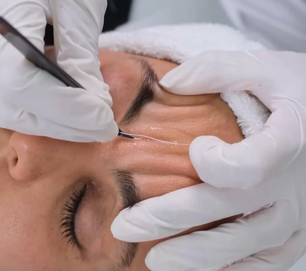 Beykoz Kolajen İp Uygulaması