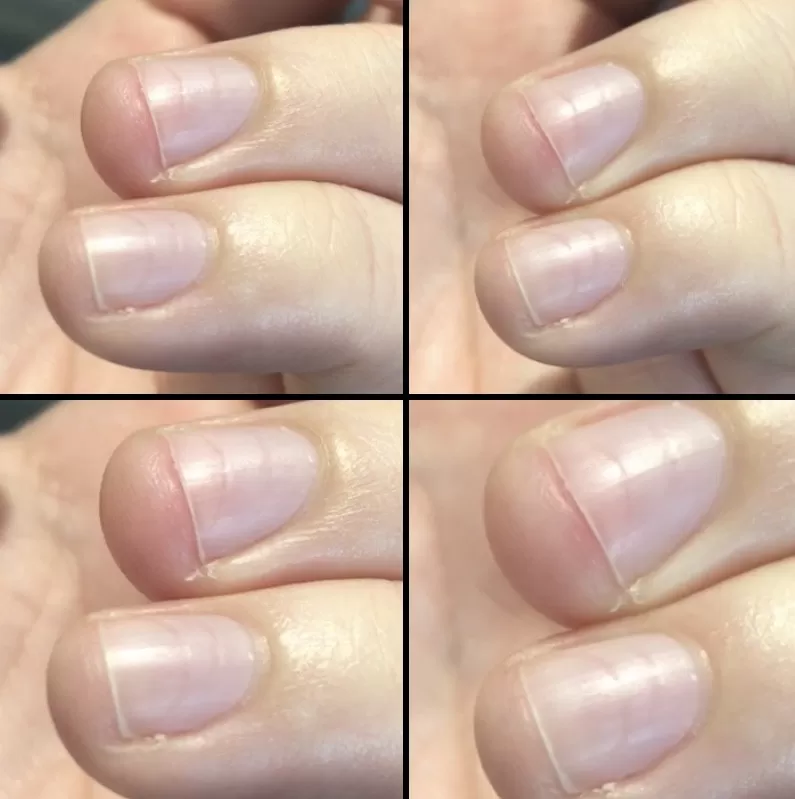 Şile Medikal Manikür