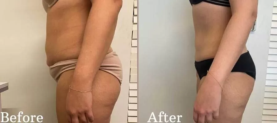  Kartal’da Magic Plus Bölgesel İncelme